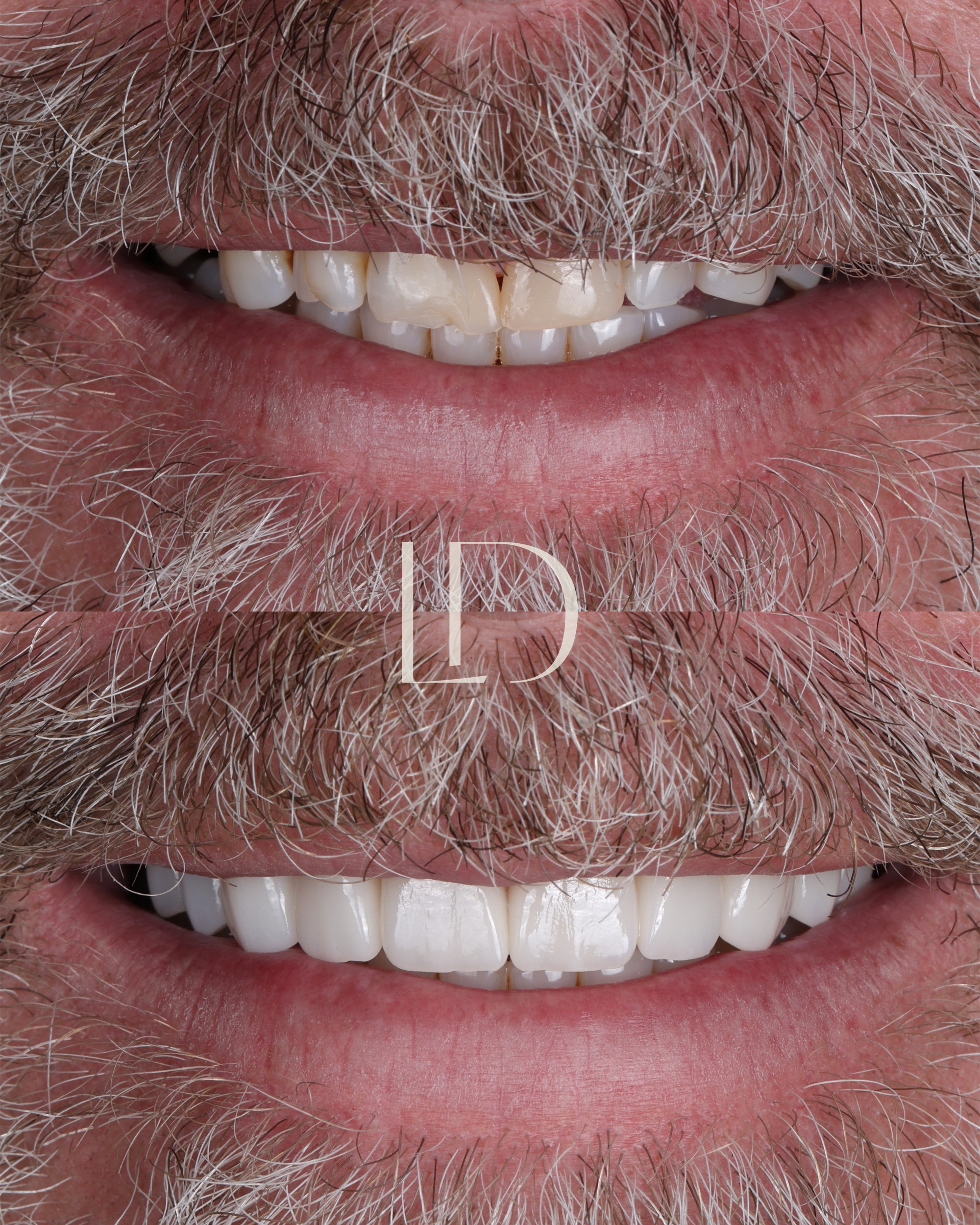 Client smile result 2
