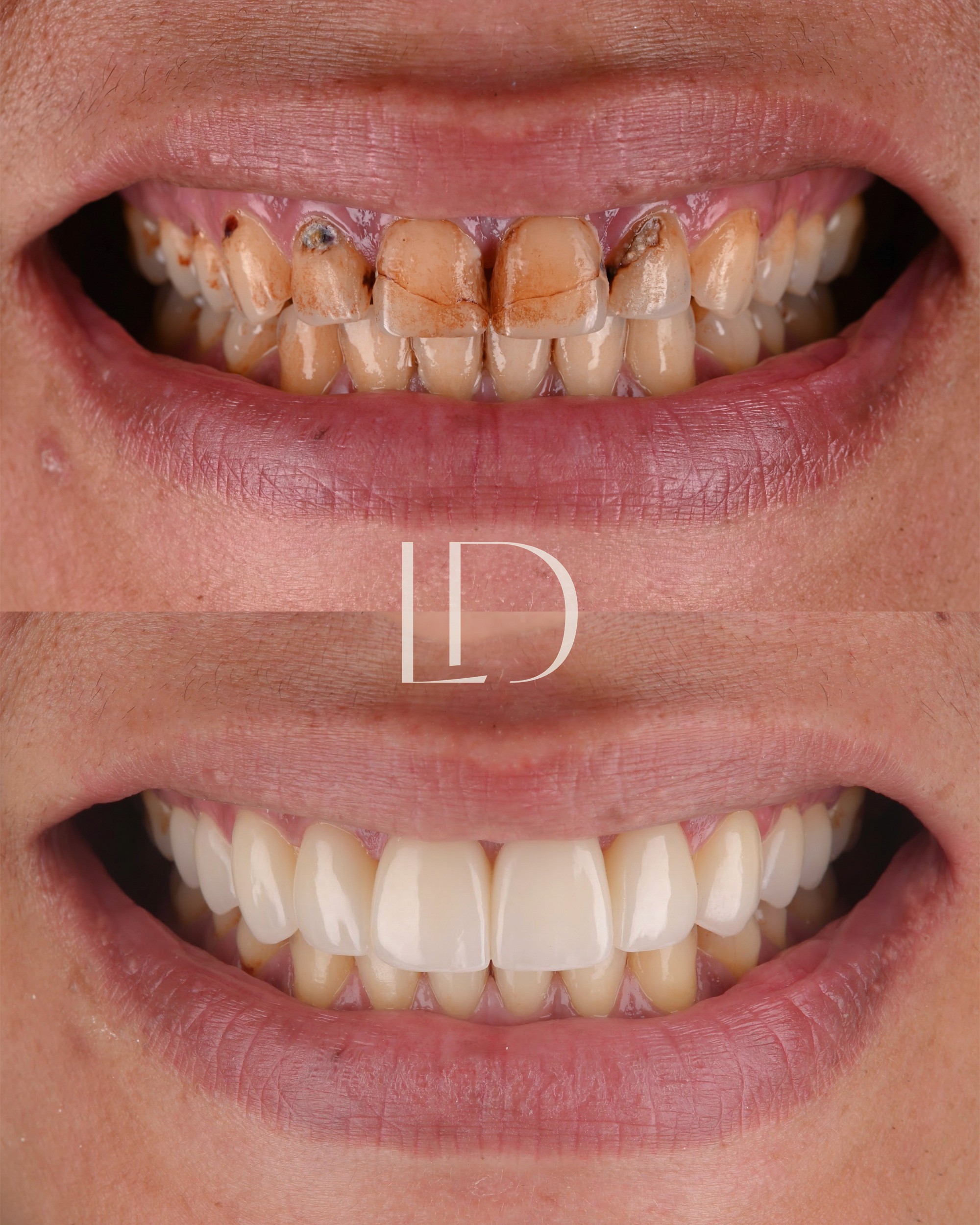 Client smile result 5