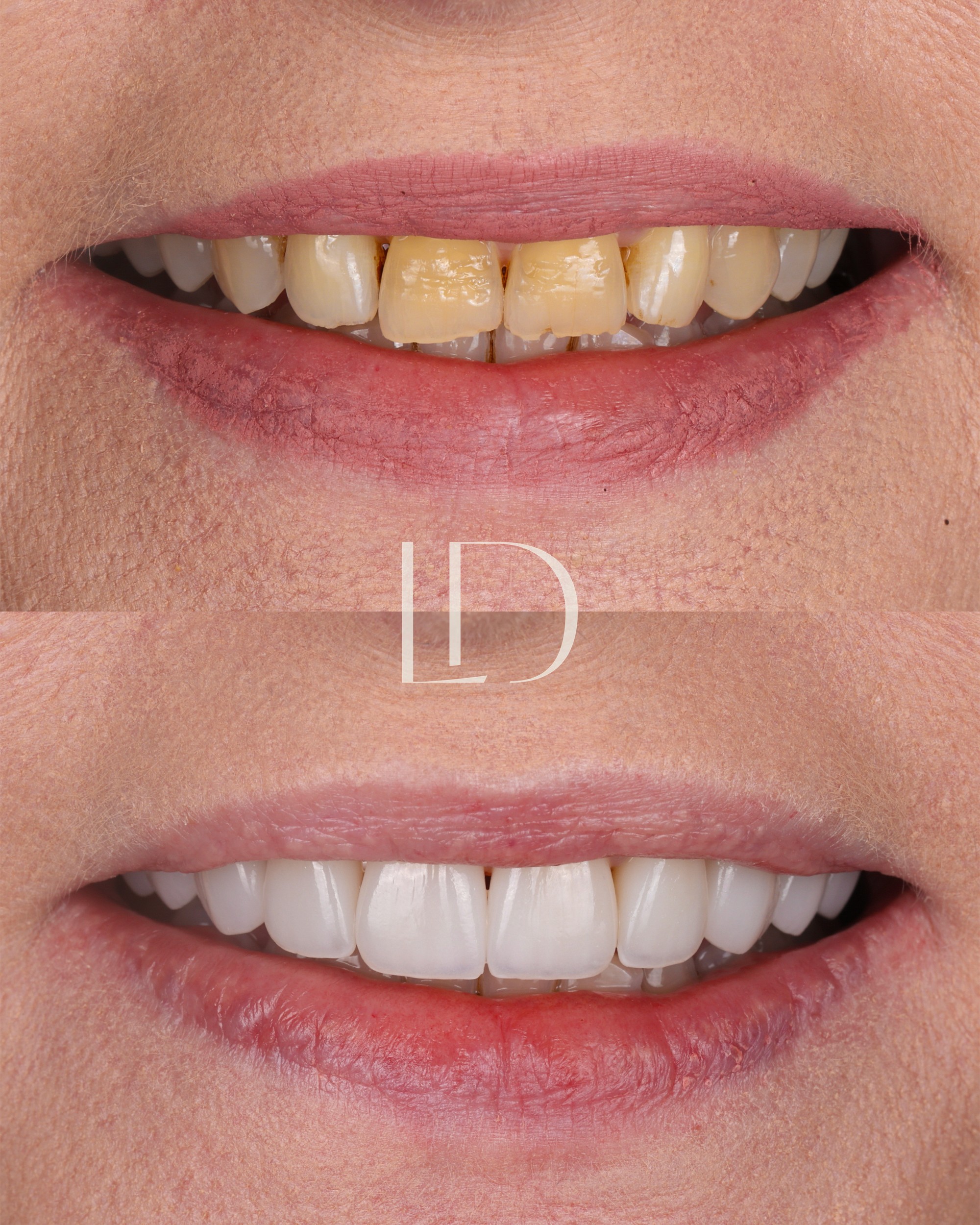 Client smile result 6