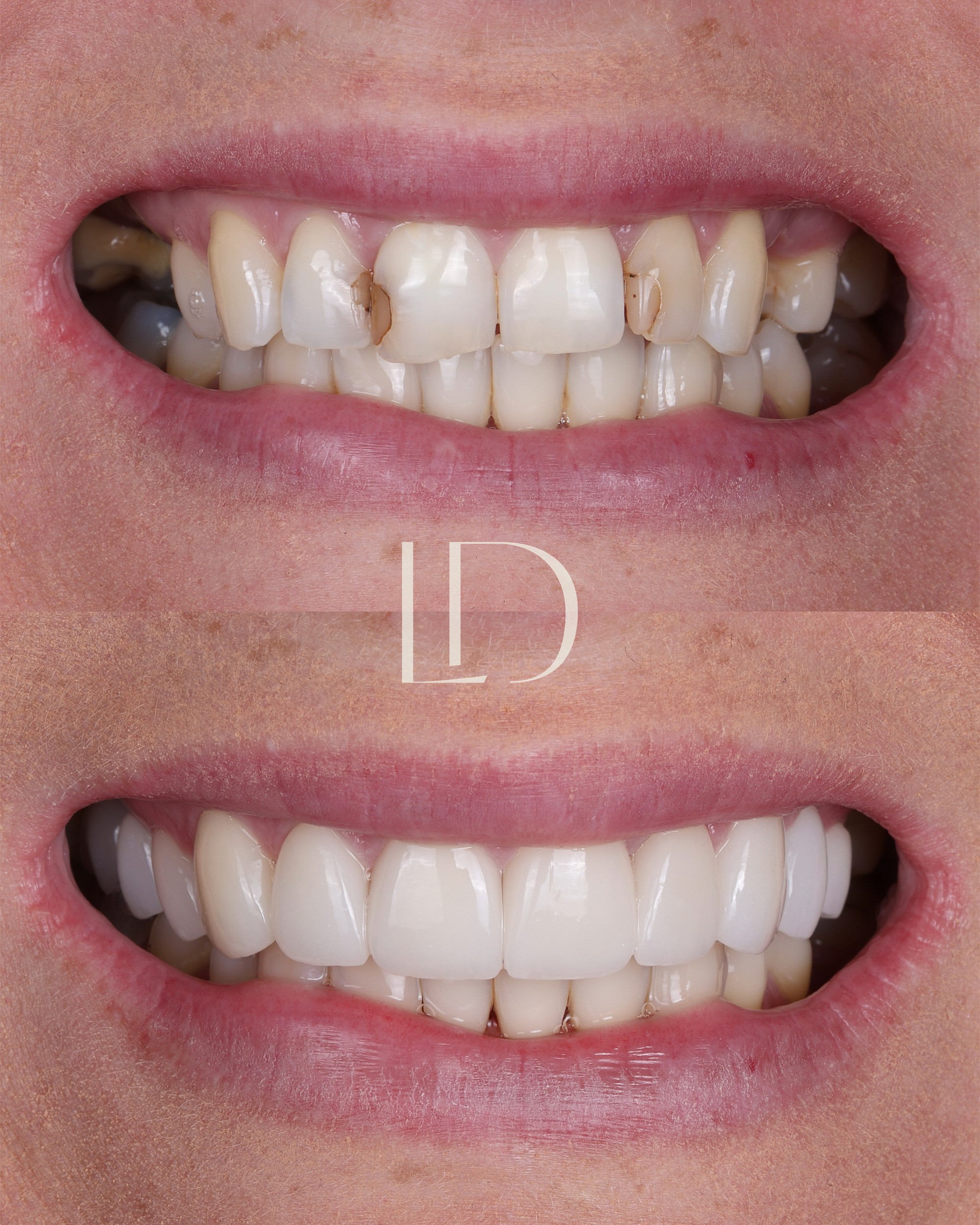 Client smile result 1