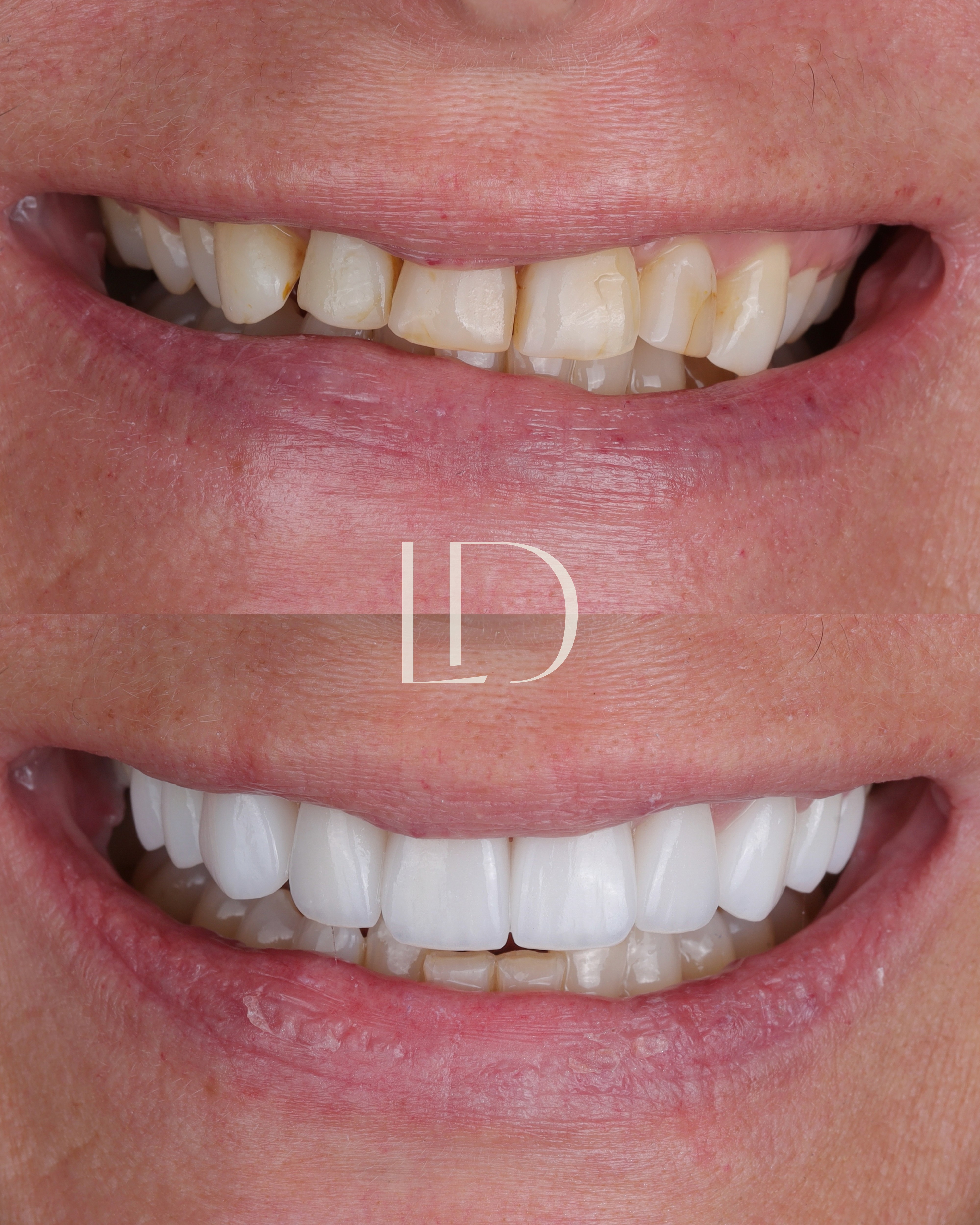 Client smile result 11