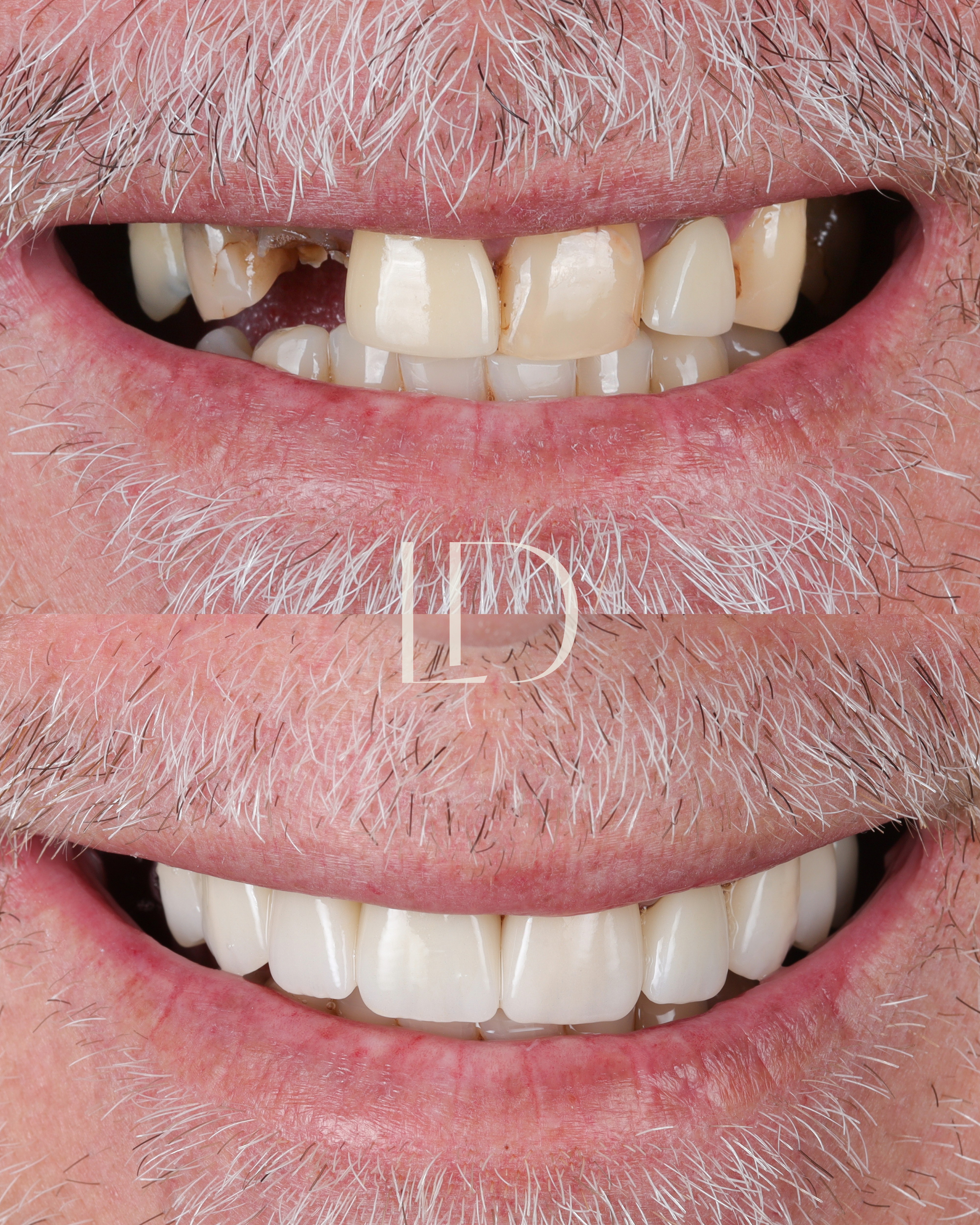 Client smile result 16