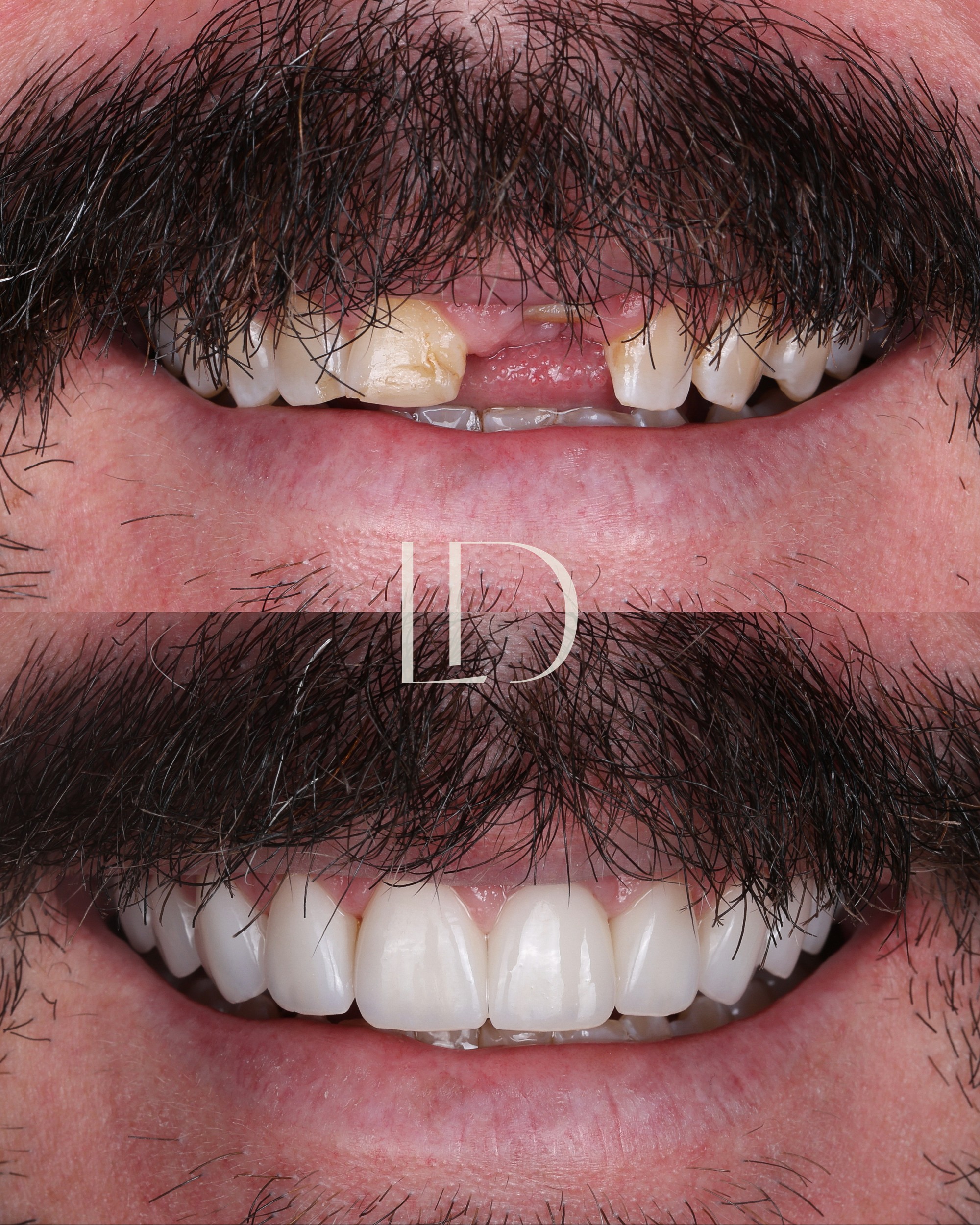 Client smile result 14