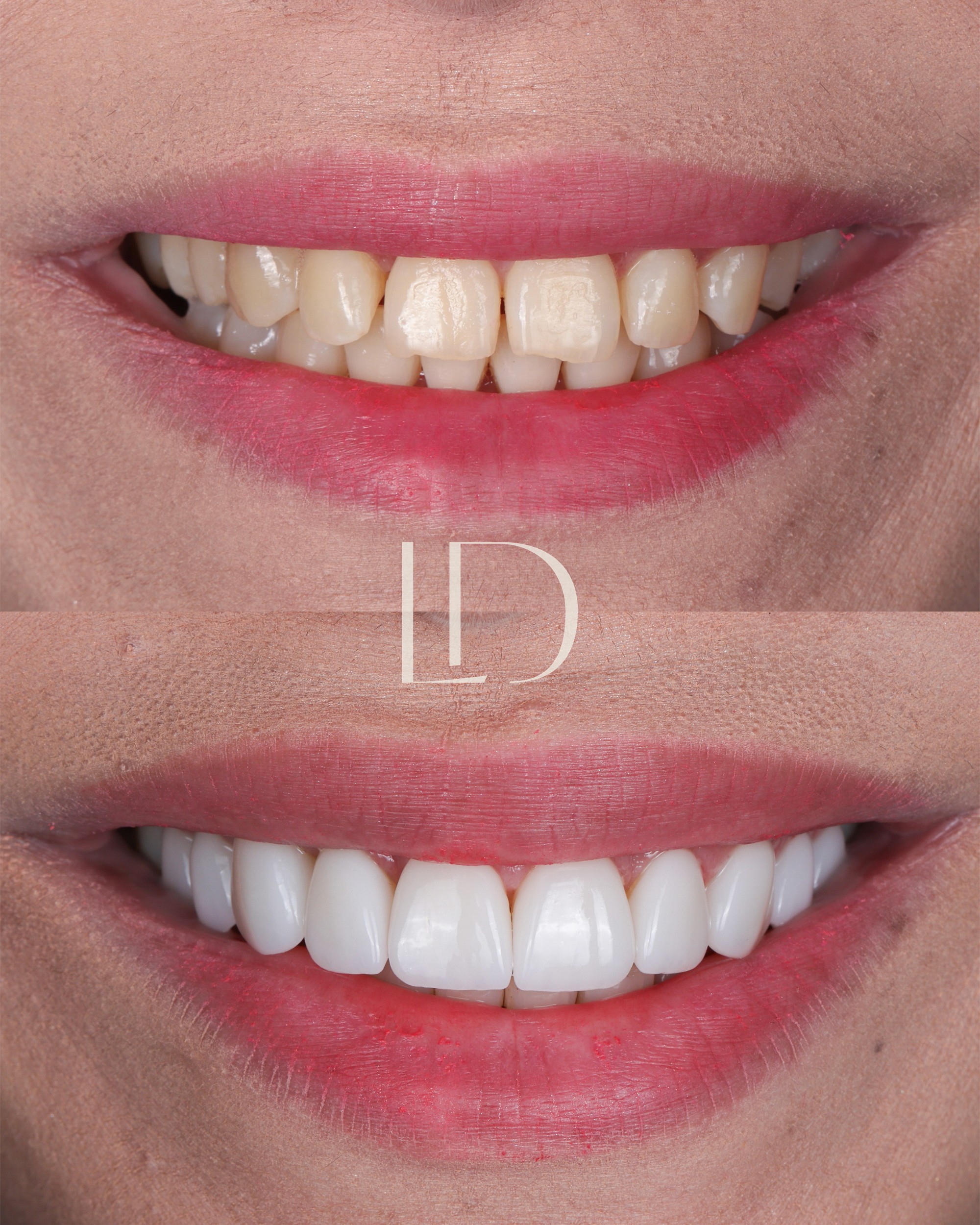 Client smile result 4