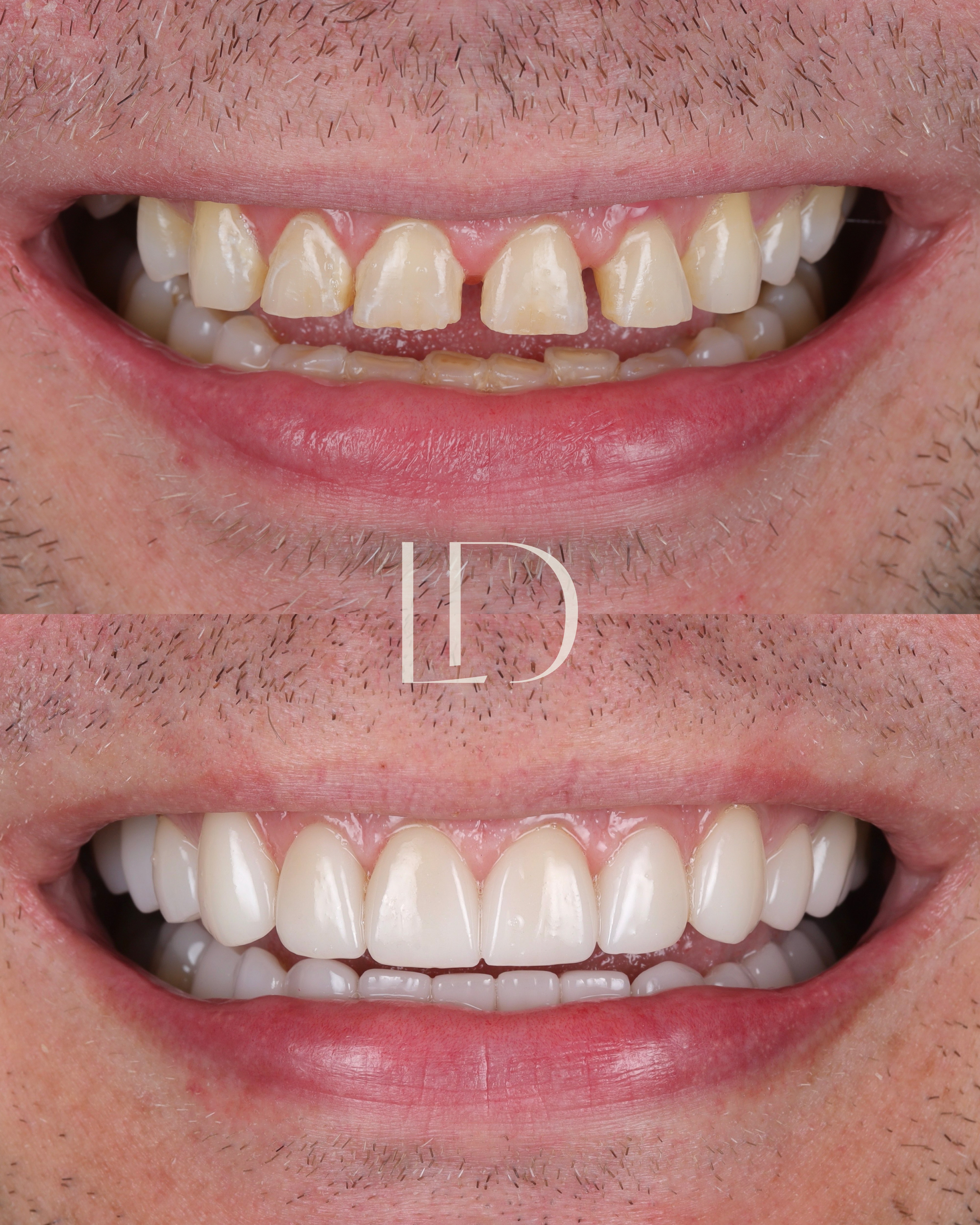 Client smile result 10