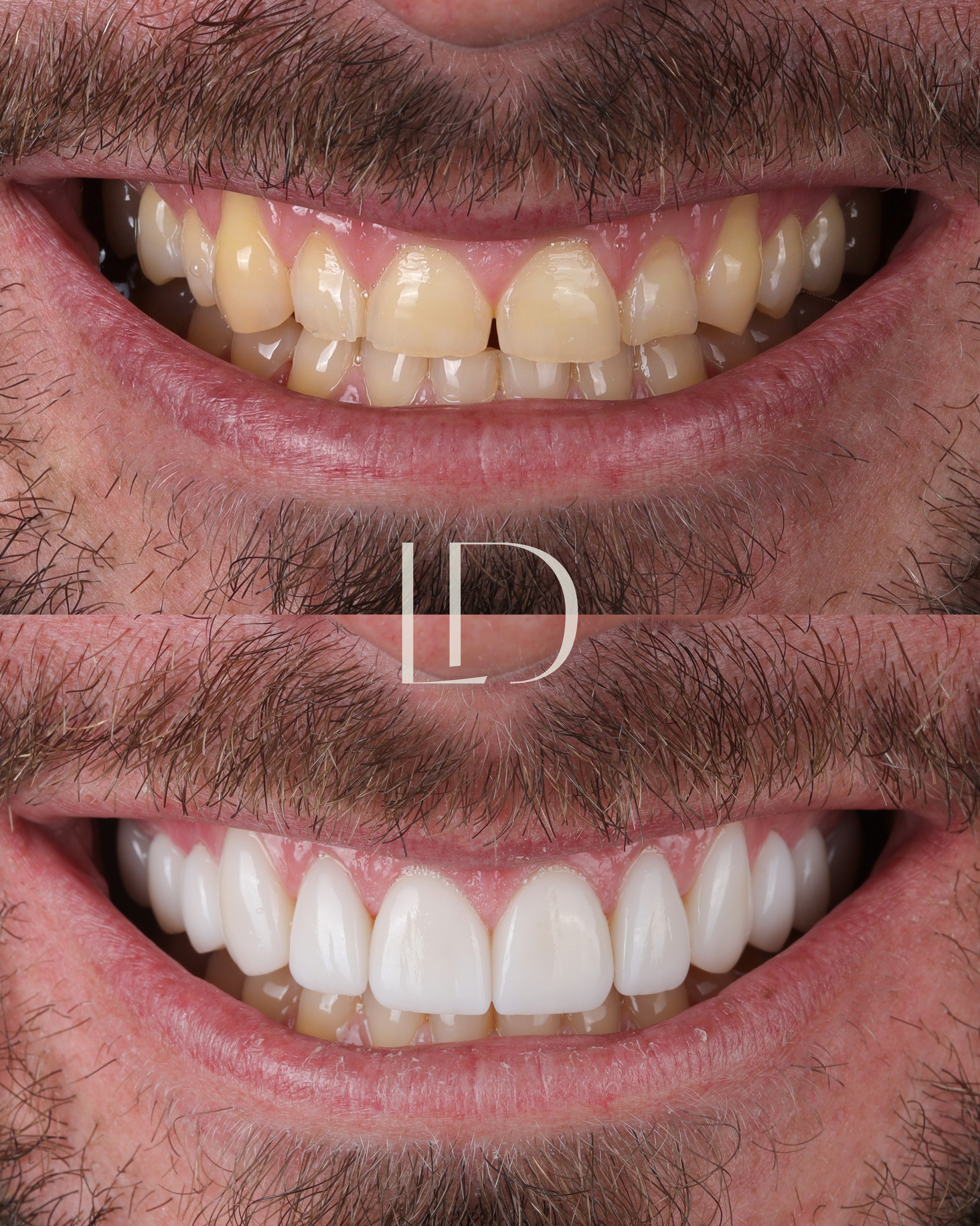 Client smile result 15