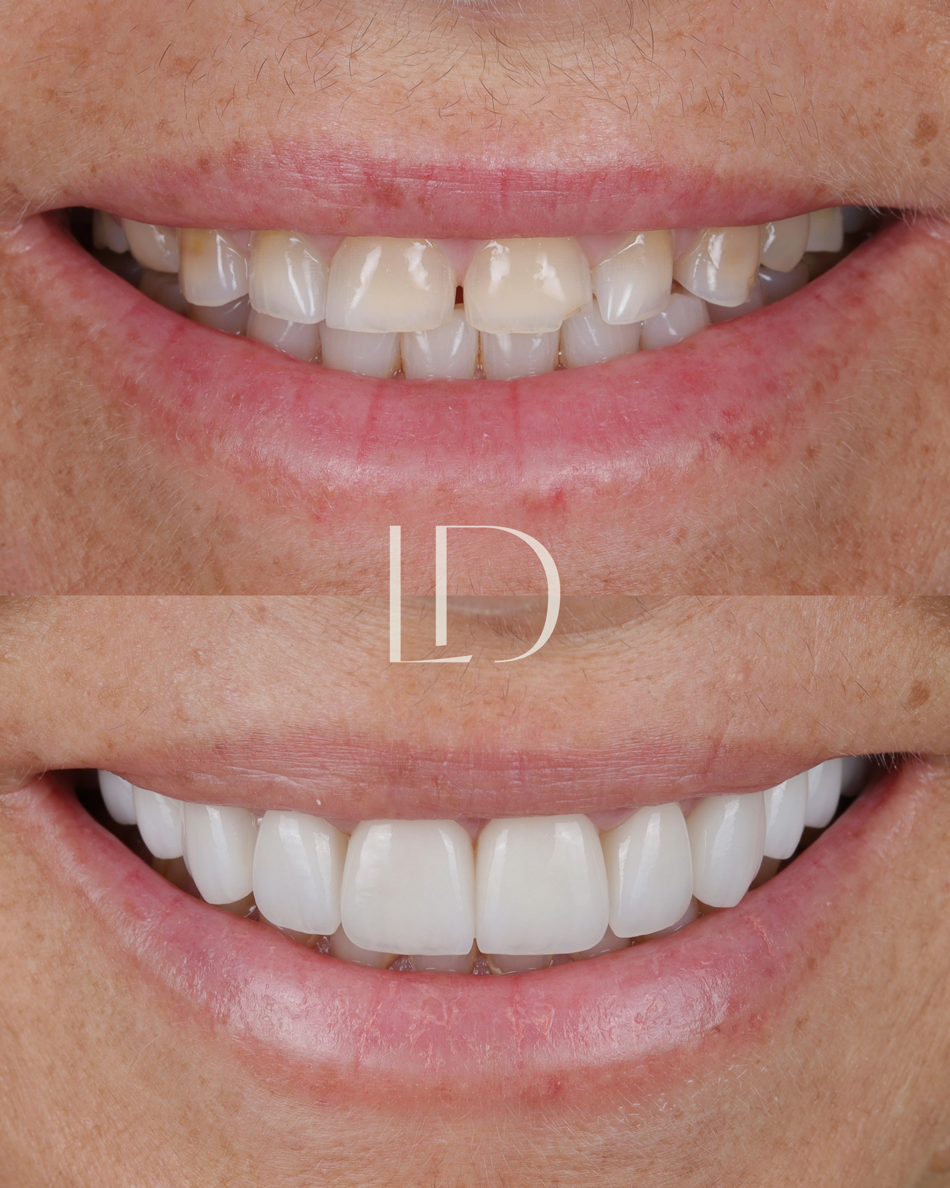 Client smile result 7