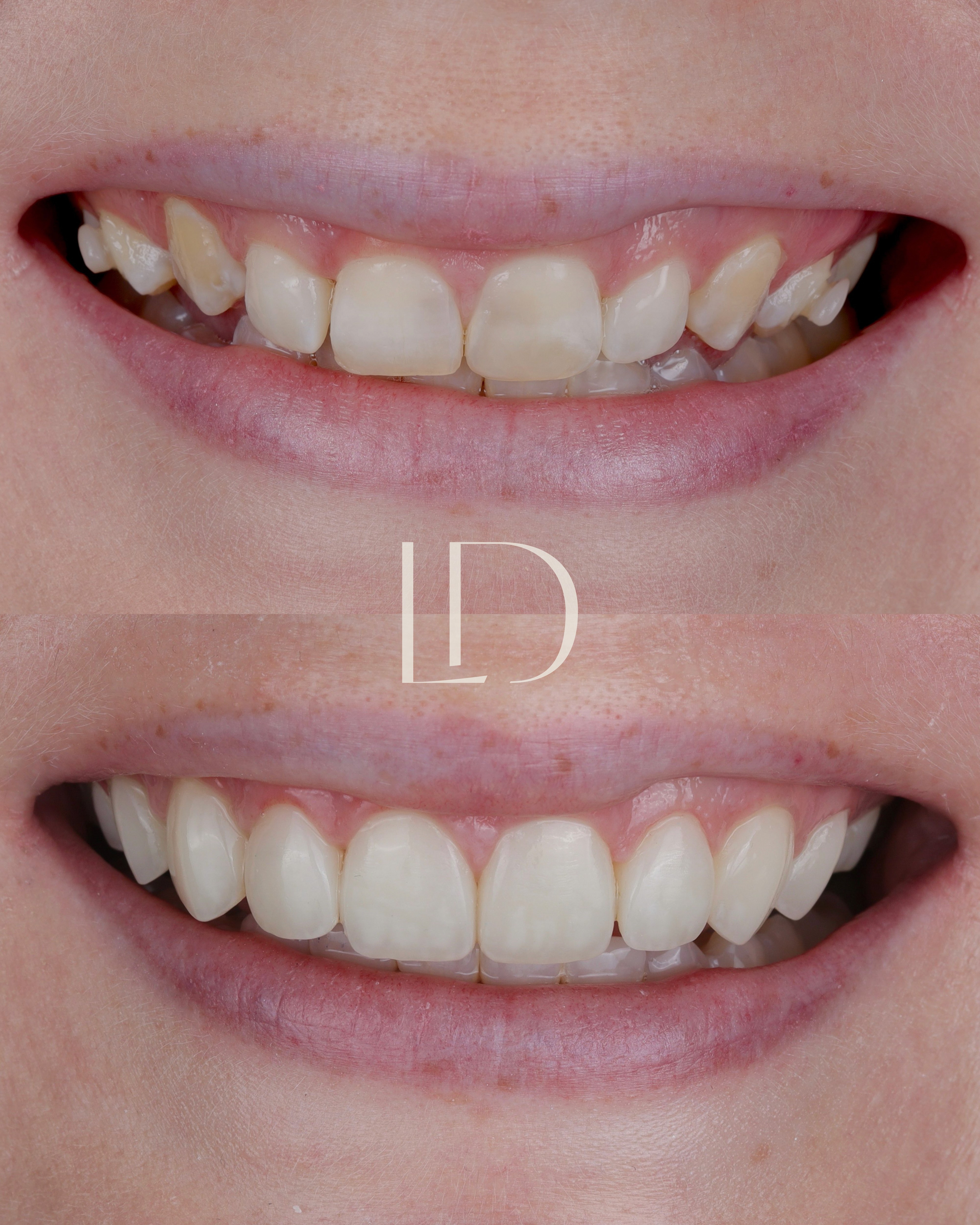 Client smile result 12
