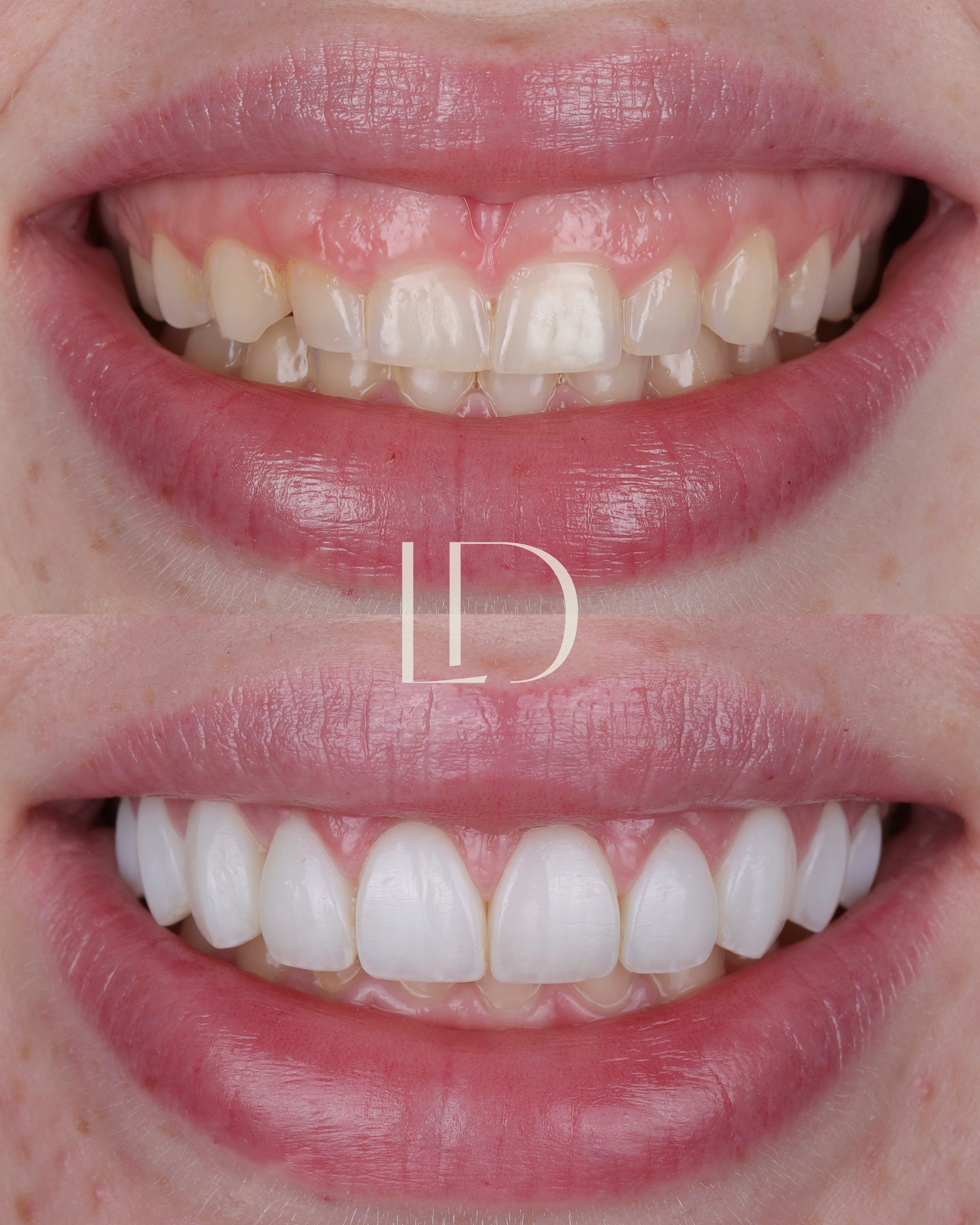 Client smile result 9