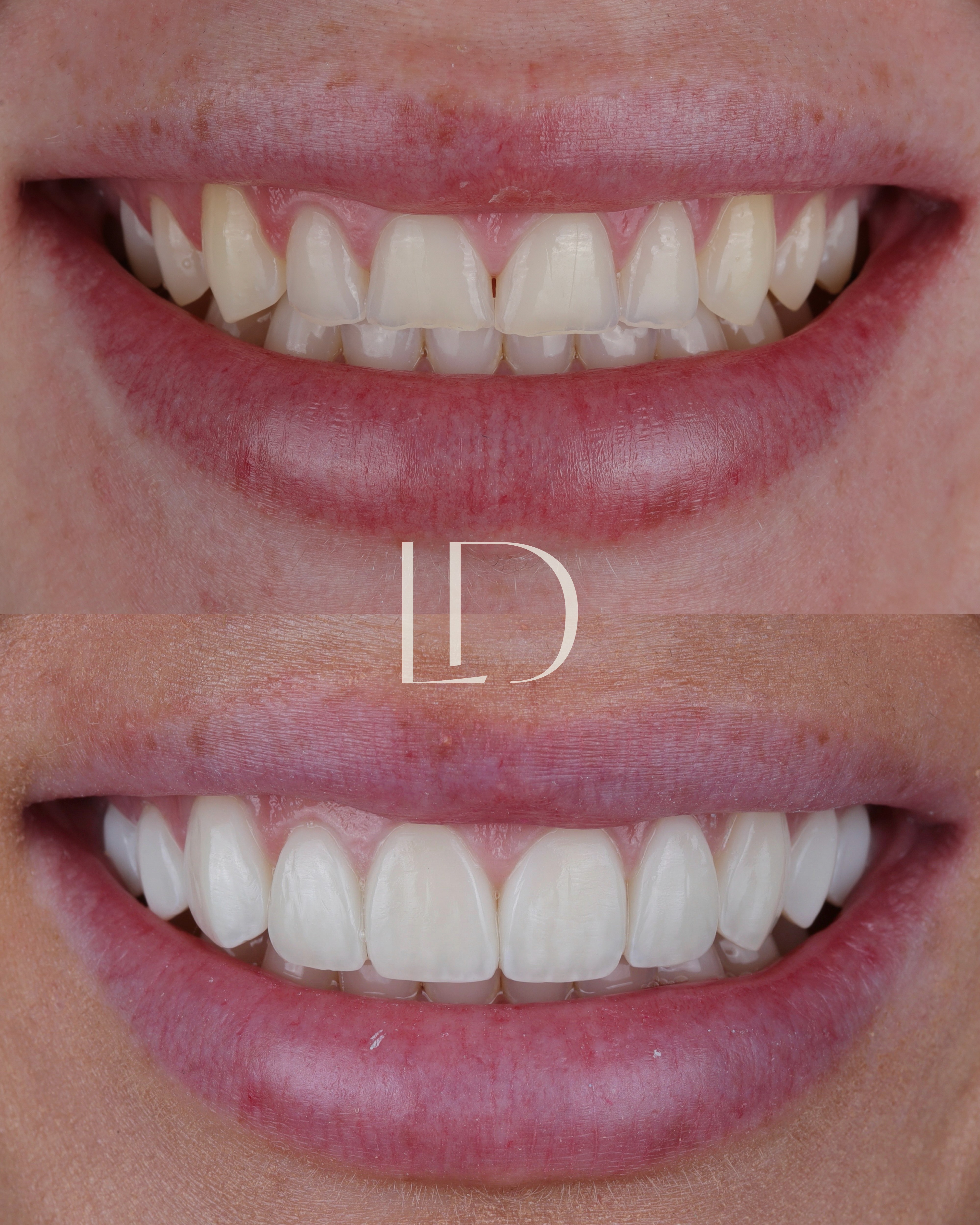 Client smile result 8