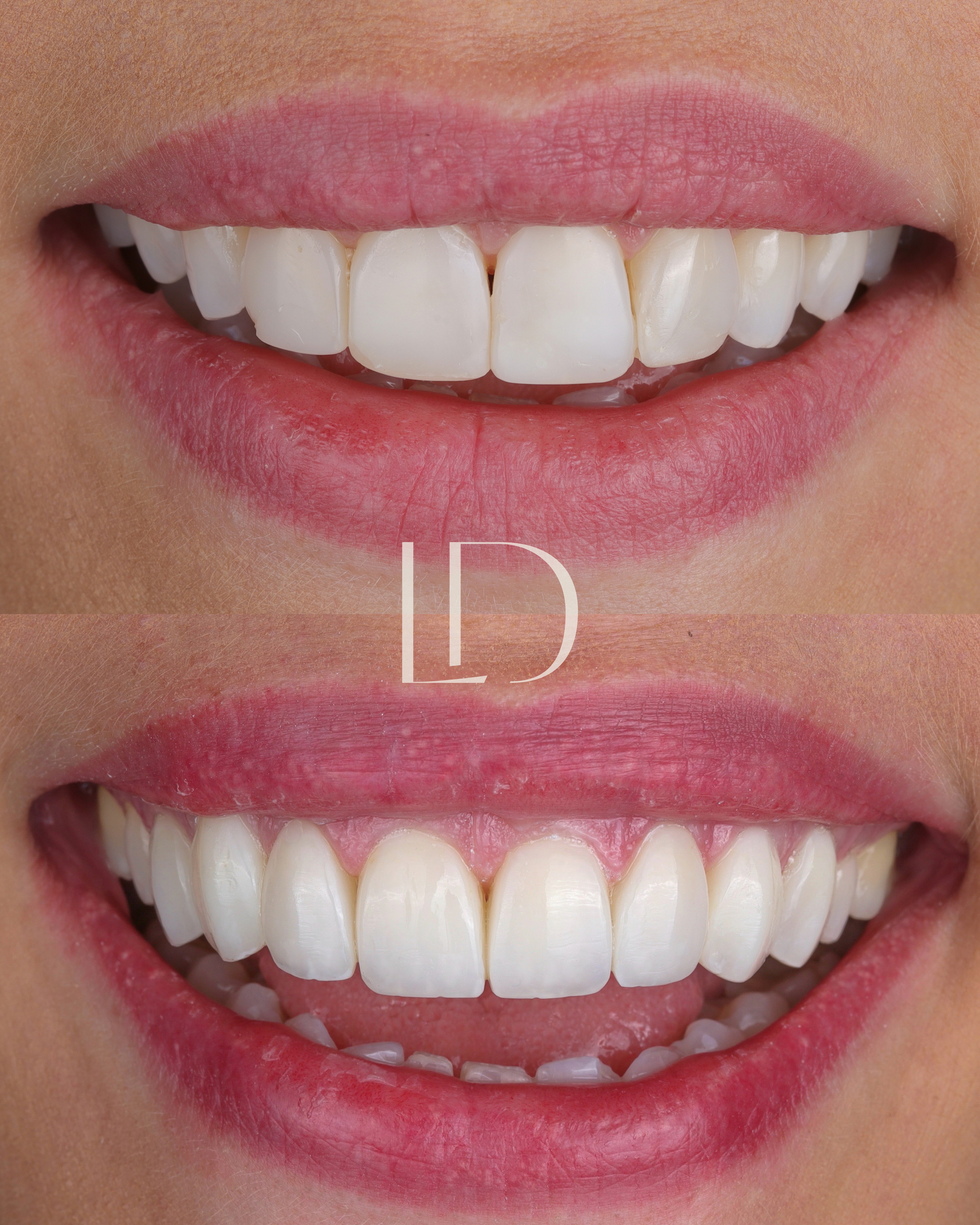 Client smile result 17