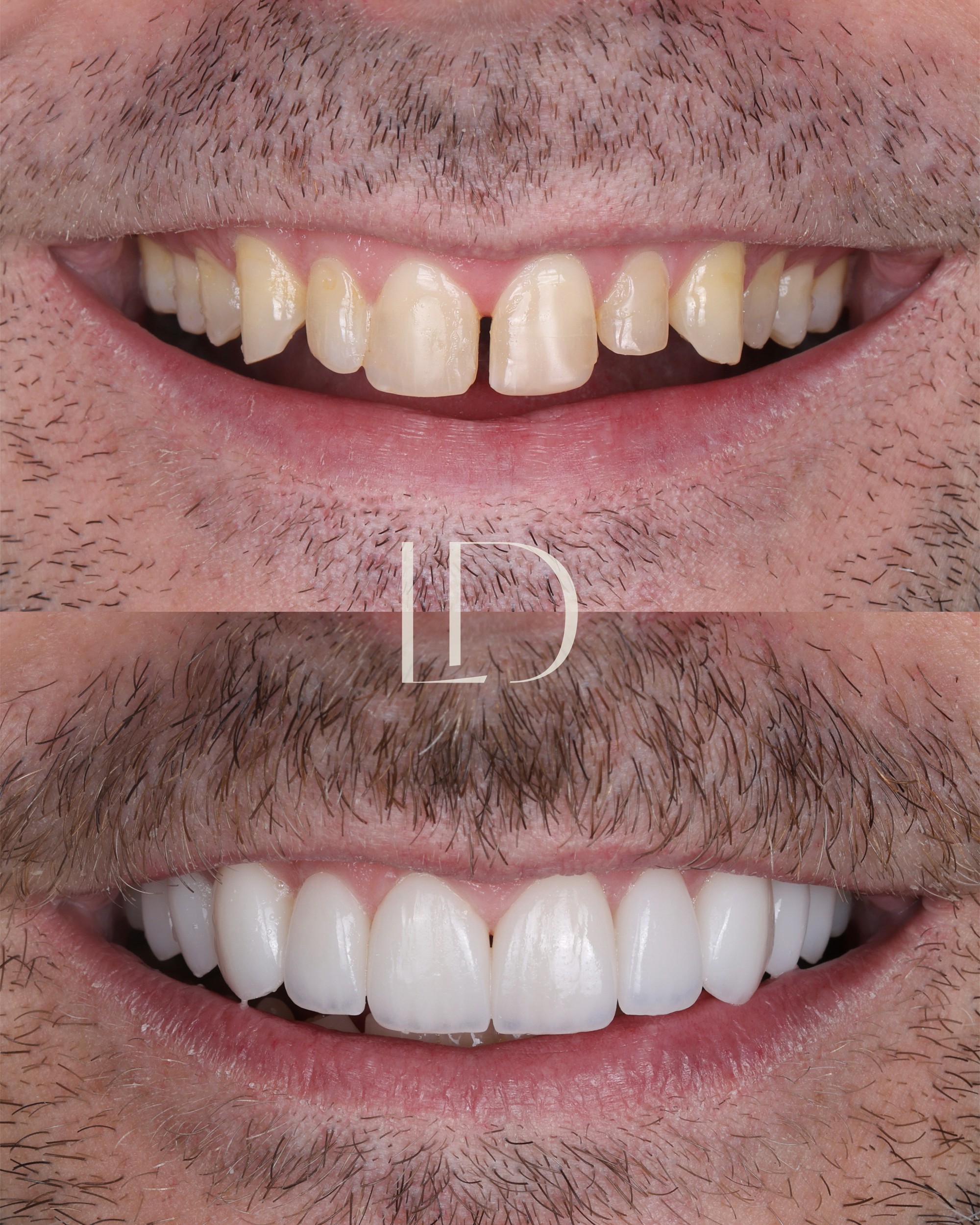 Client smile result 13