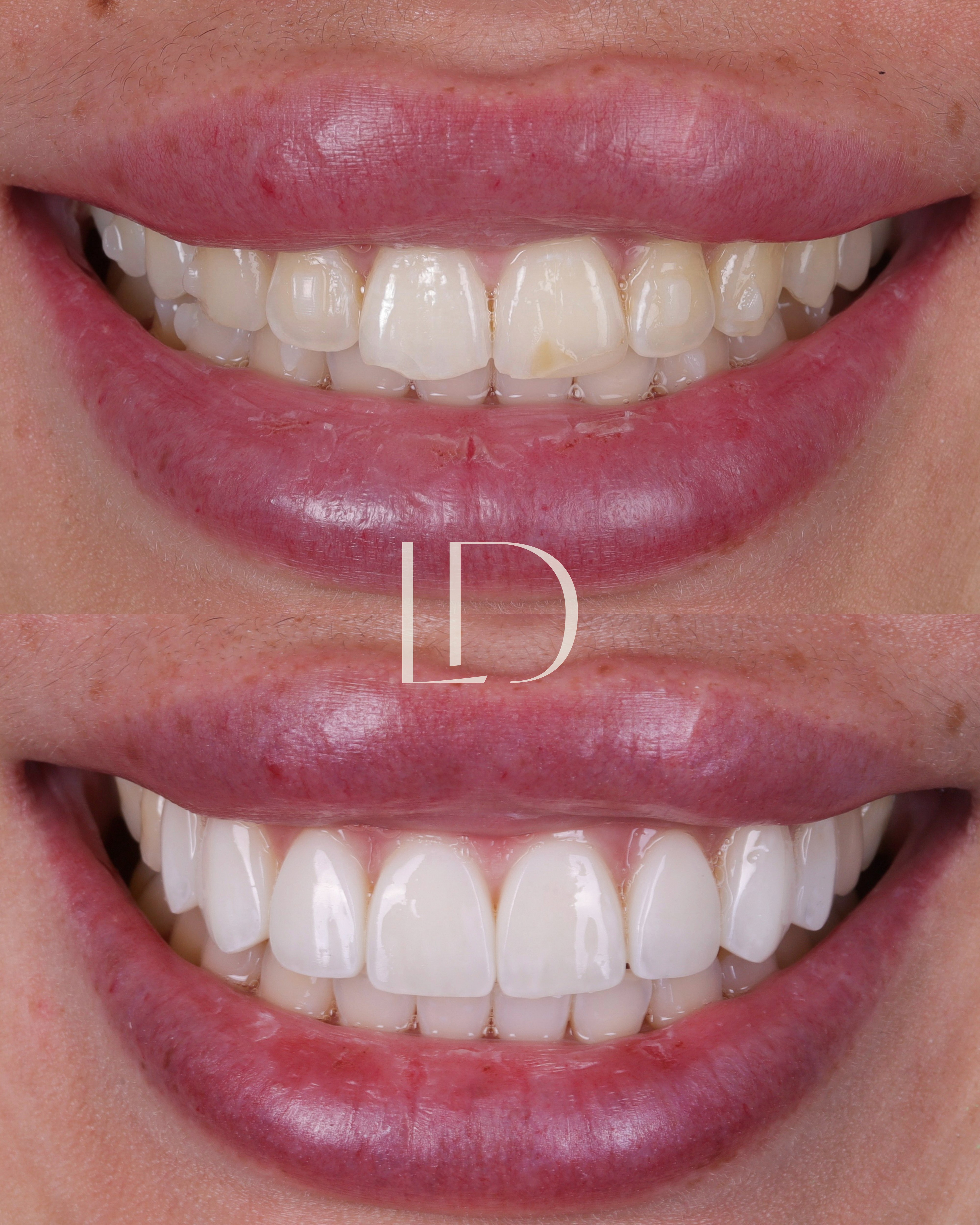 Client smile result 18